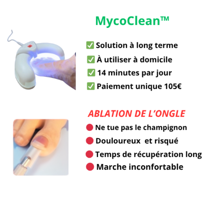 MycoClean™ – Ongles Sains, Sans Chimie
